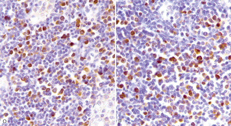 FIGURE 17-1