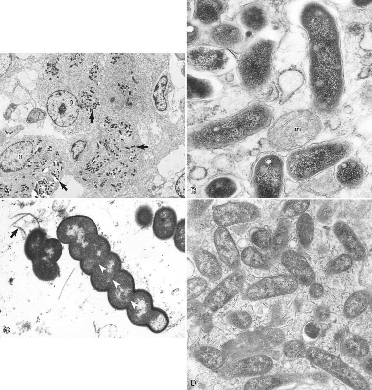 FIGURE 17-6