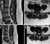 FIG. 1.