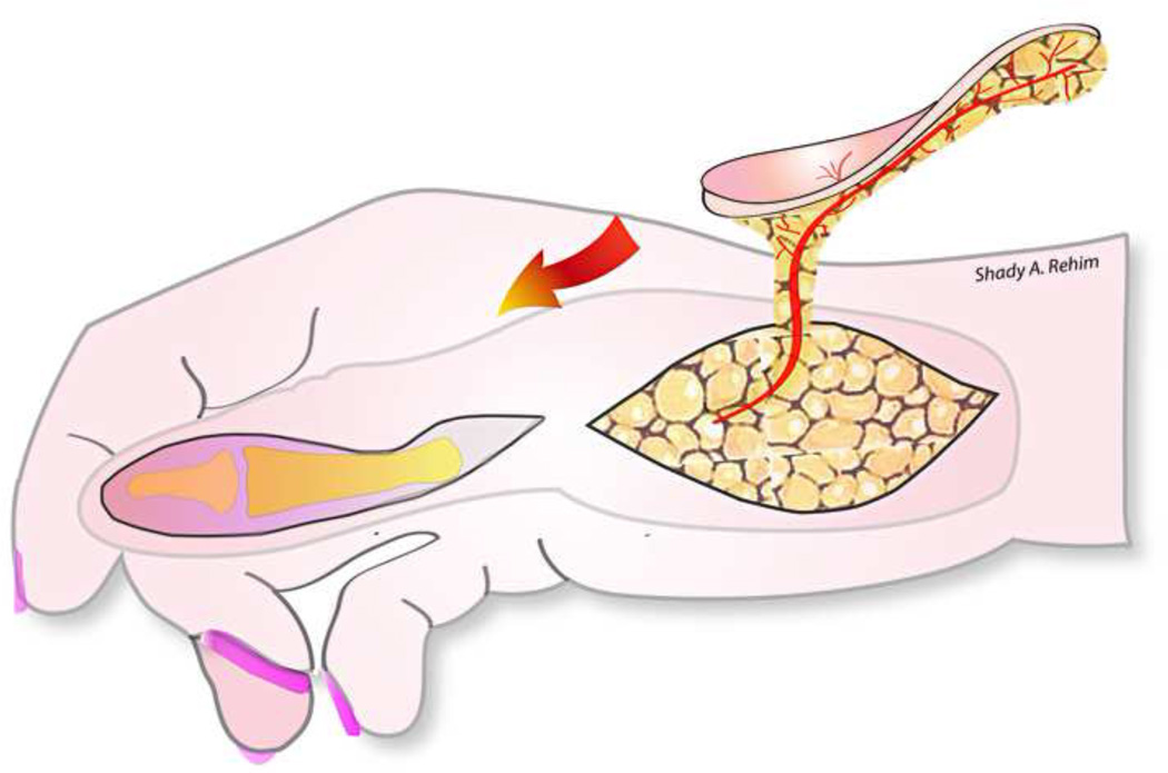 Figure 16