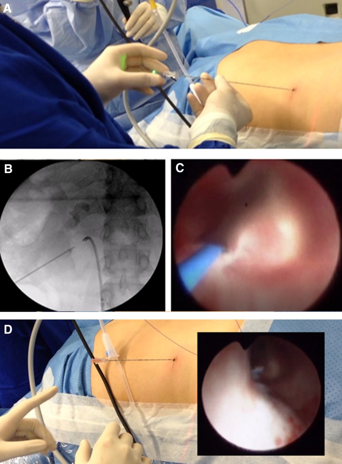 FIG. 3.