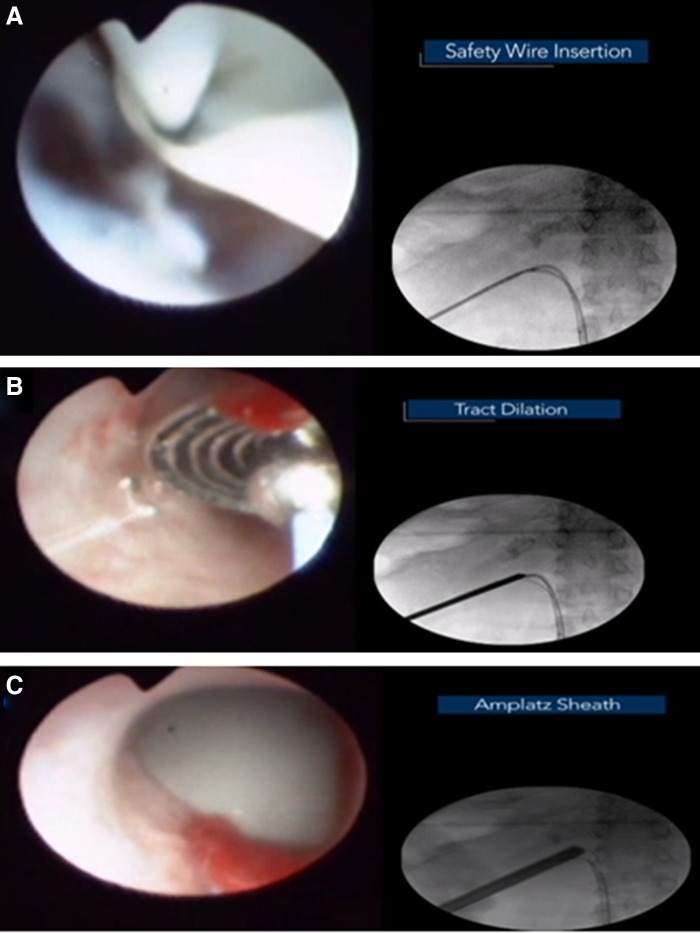 FIG. 4.