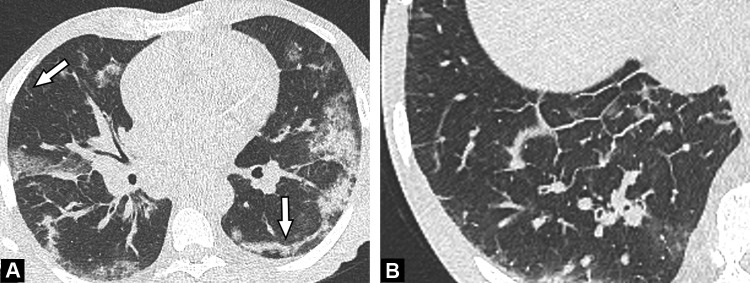 Fig. 11