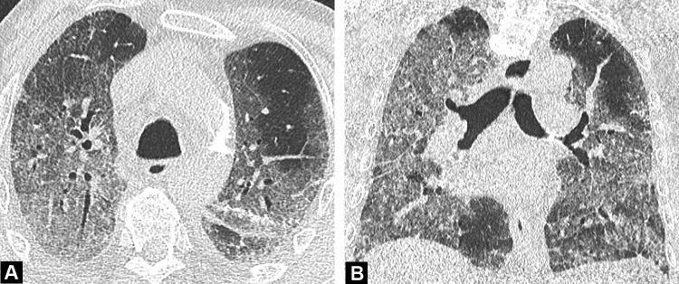 Fig. 5