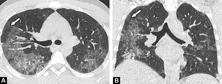 Fig. 9