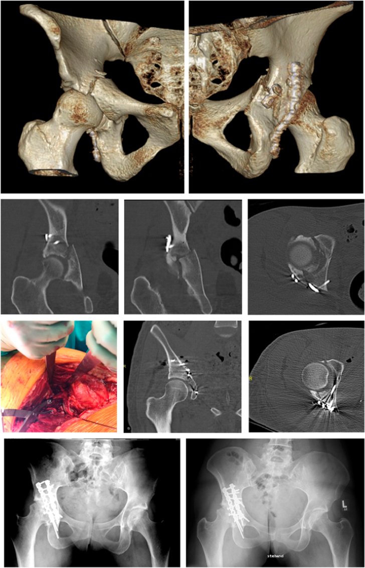 Fig. 1