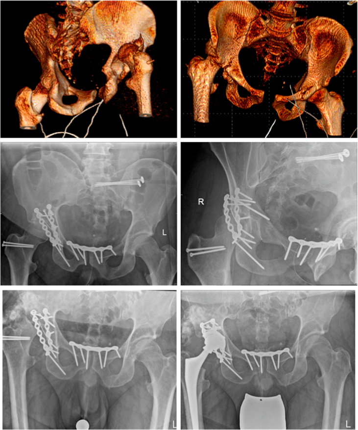 Fig. 3