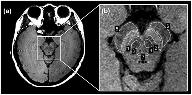 Fig 1