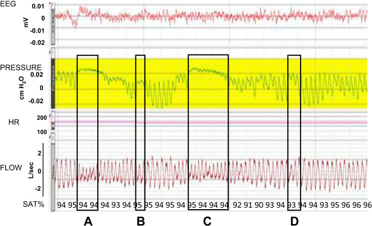 Fig. 3.