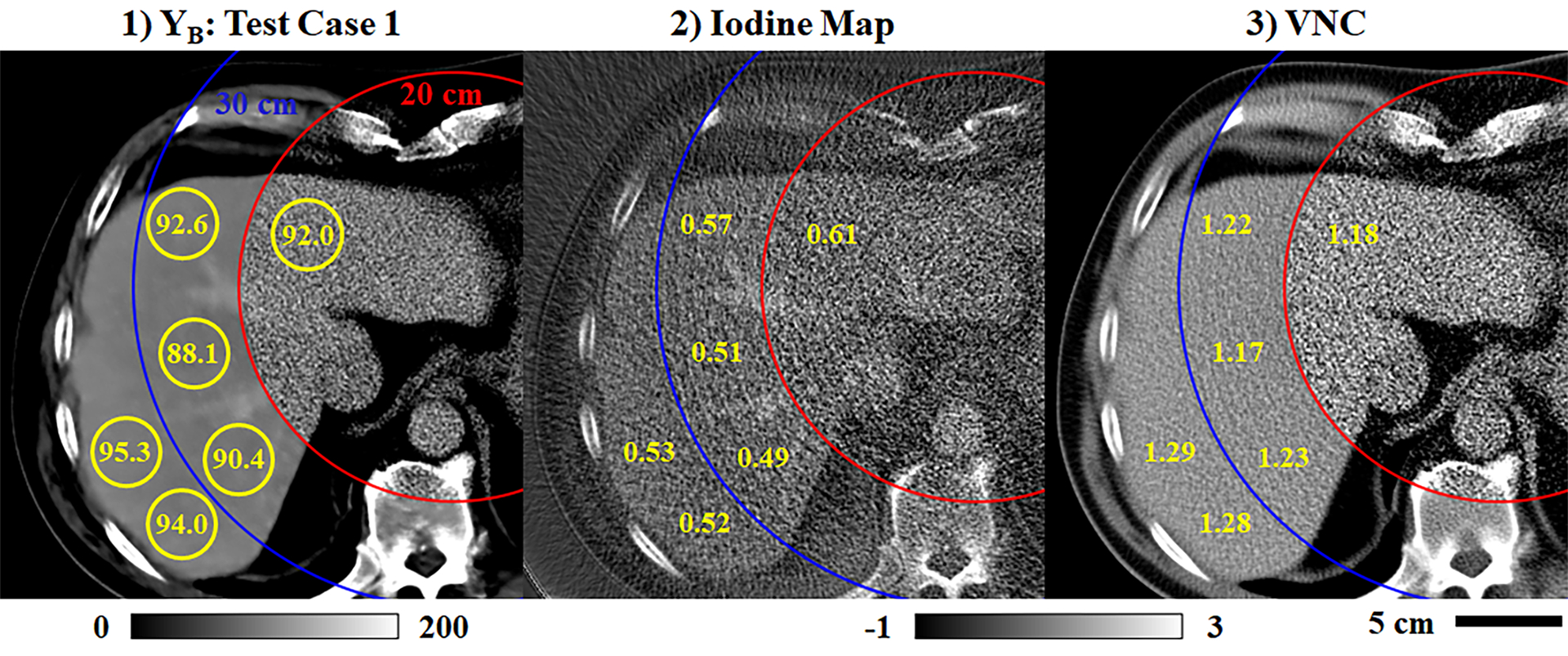 Fig. 12.