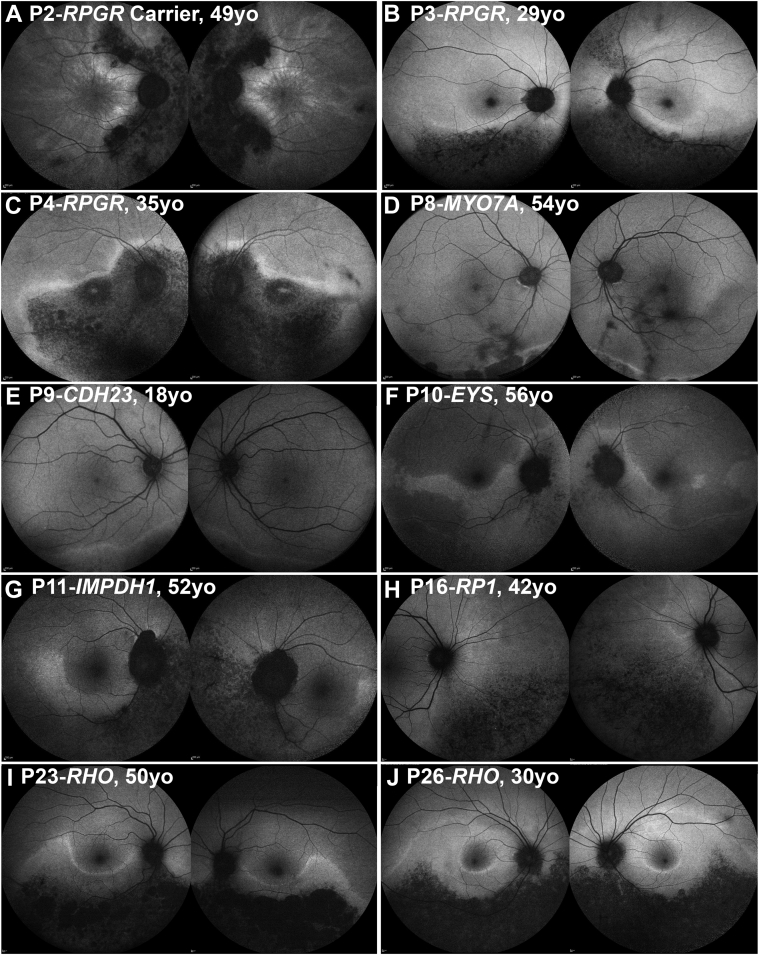 Figure 2