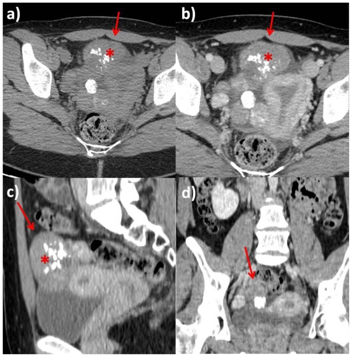 Figure 6