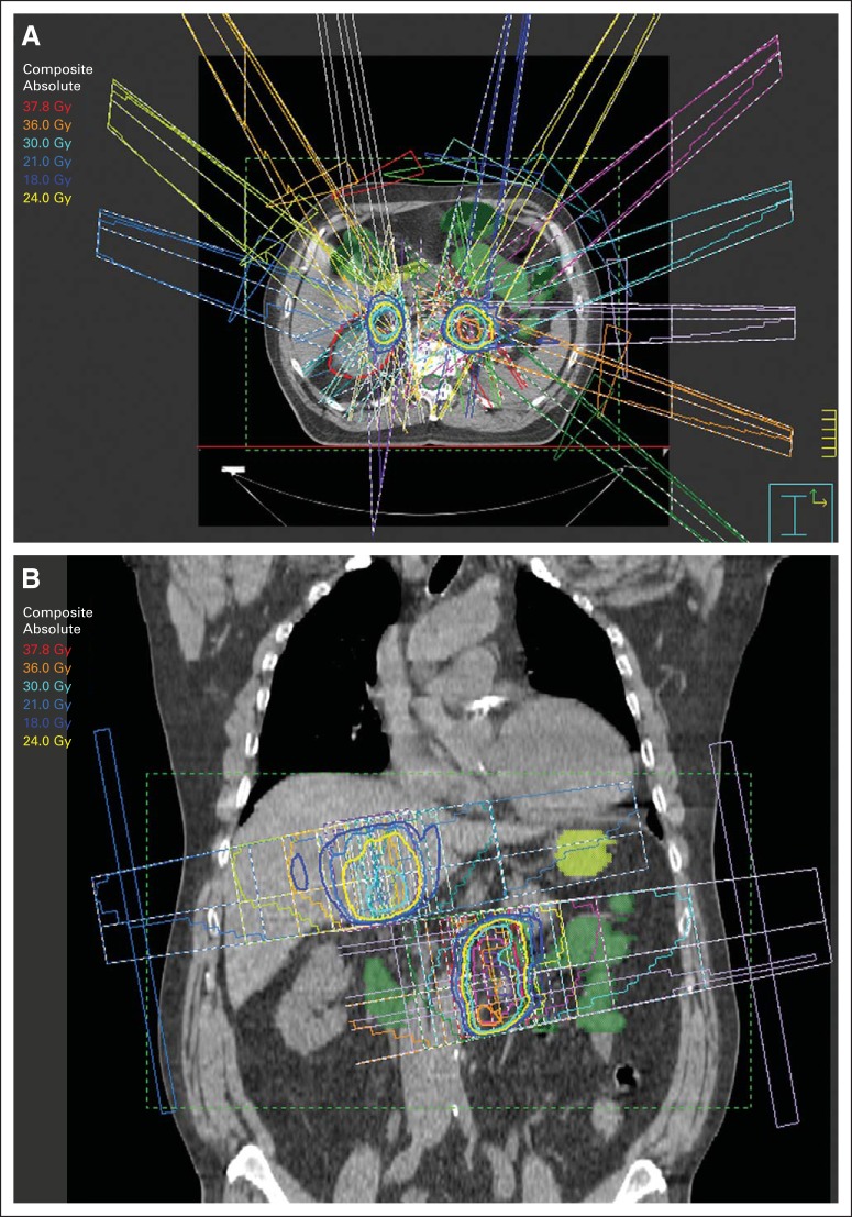 Fig 1.