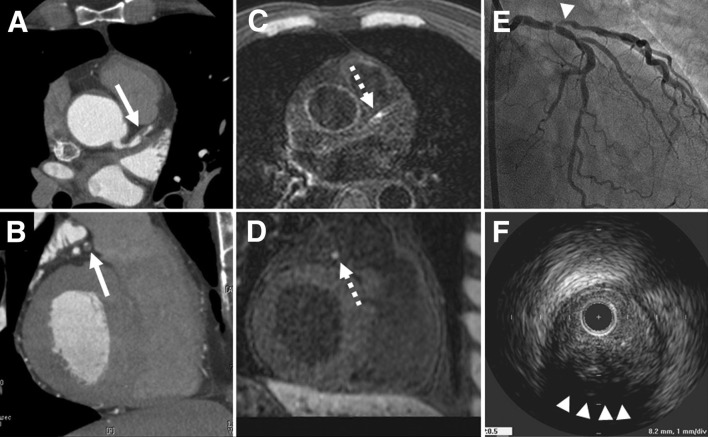 Fig. 9