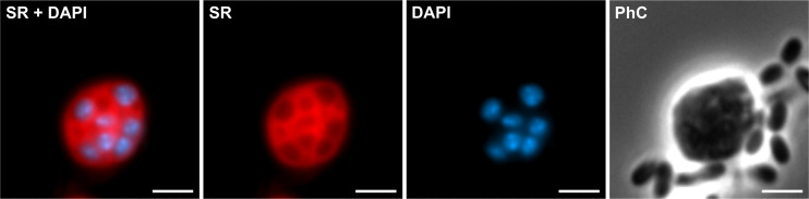 Fluorescence microscopy images depict a bacterial cell stained with SR and DAPI, highlighting cellular structures and DNA, respectively. It includes combined SR+DAPI, SR only, DAPI only, and phase contrast.