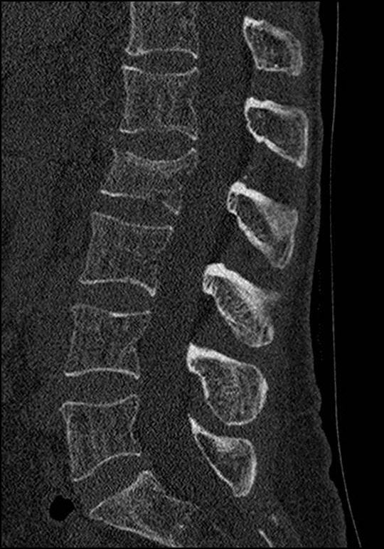 Figure 13.