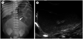 Fig. 13