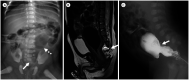 Fig. 18