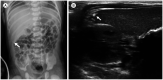 Fig. 12