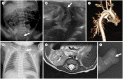 Fig. 17