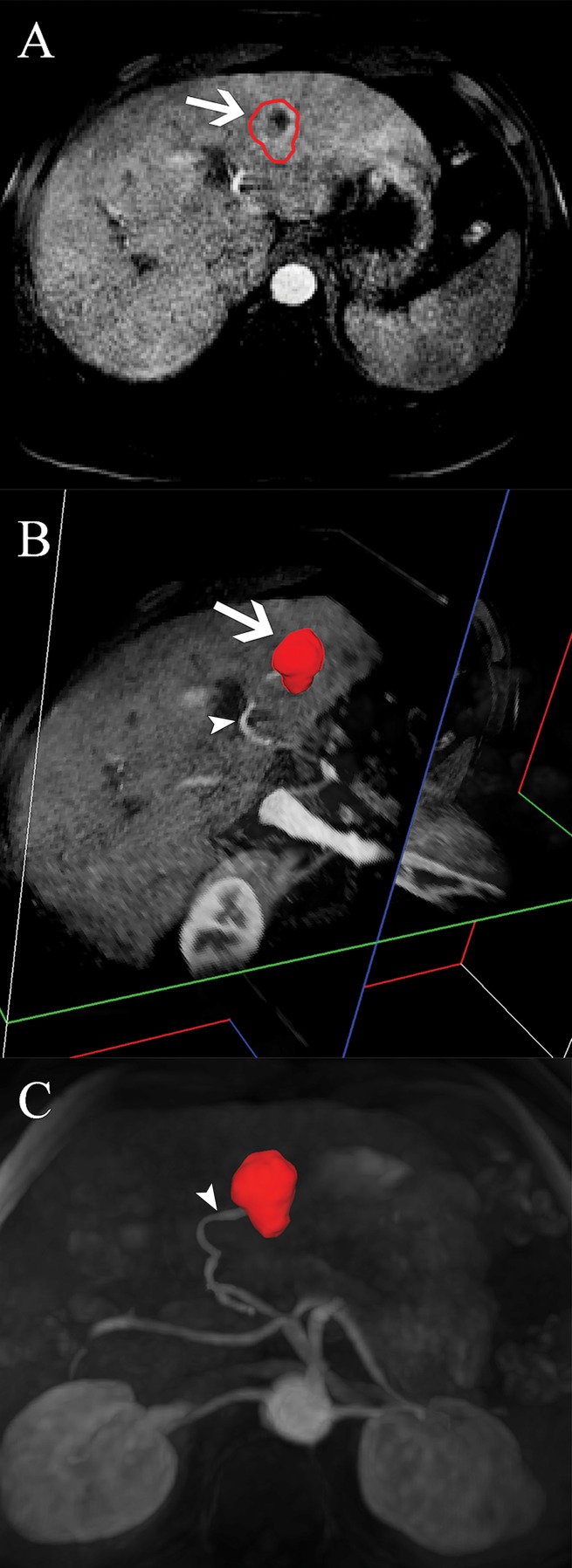 Figure 1b: