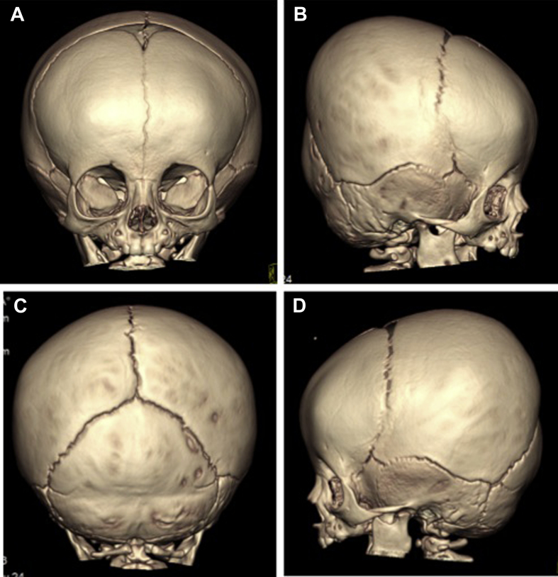 Figure 2