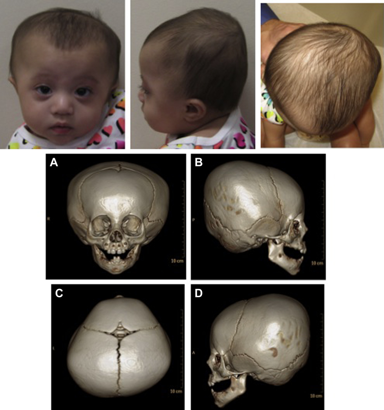 Figure 3