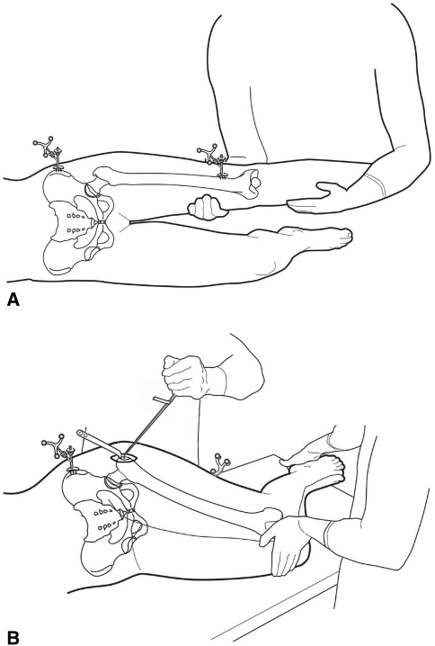 Fig. 4A–B