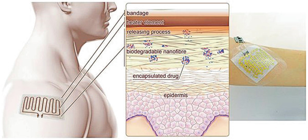 Figure 12