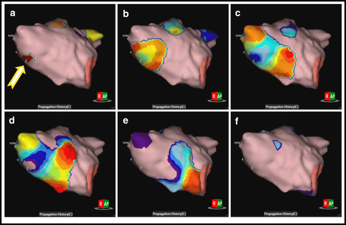 Fig. 3