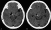 Figure 3 (A,B)