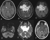 Figure 1 (A-F)