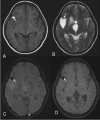 Figure 2 (A-D)