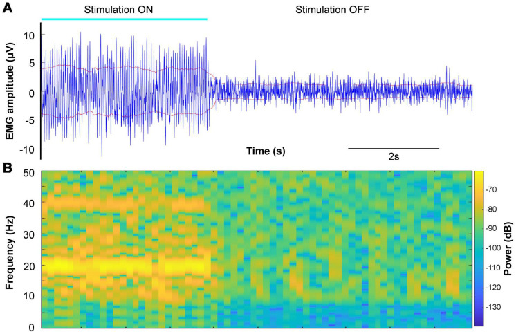 FIGURE 4