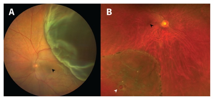 Figure 1: