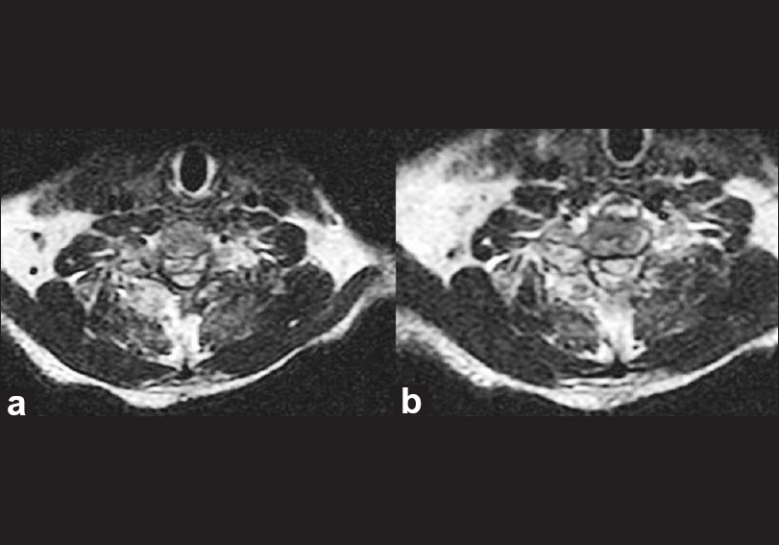 Figure 2 (a, b)