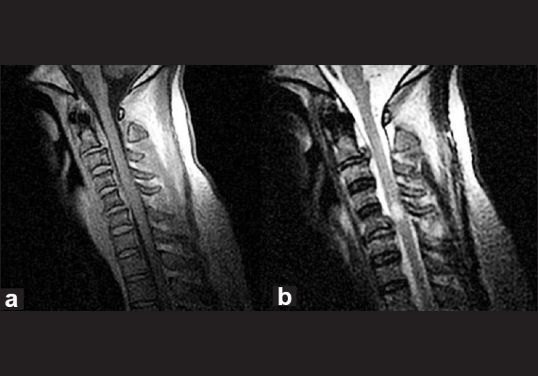 Figure 3 (a, b)