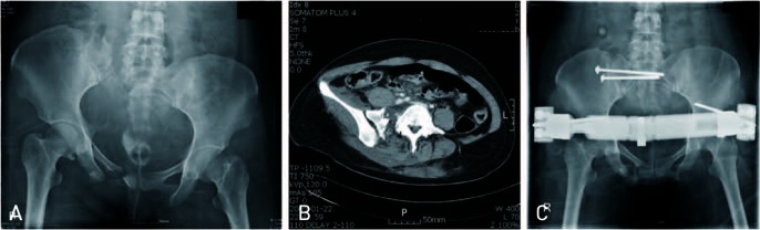 Fig. 2