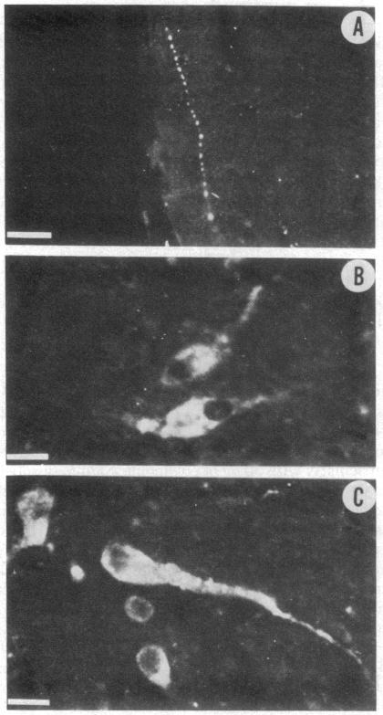 graphic file with name pnas00003-0488-a.jpg