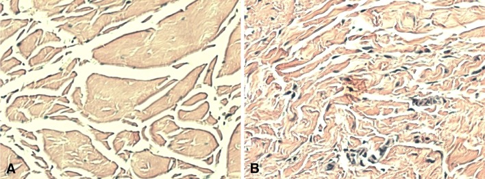 Fig. 1A–B