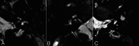 FIG 3.