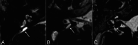 FIG 4.
