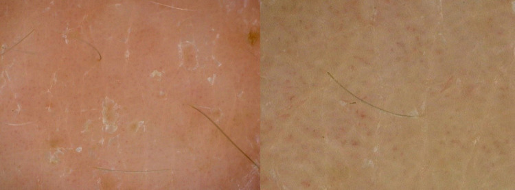 Figure 9