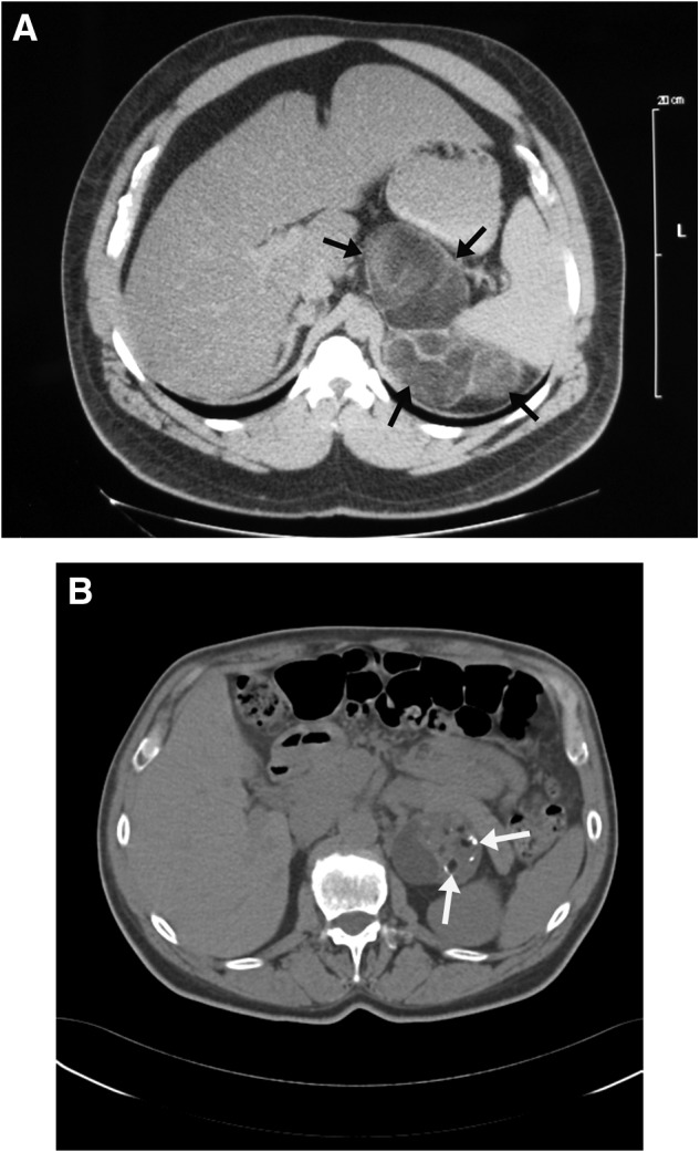 FIG. 1.