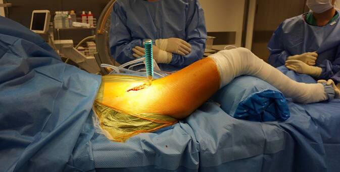 graphic file with name 64_2022_771_Fig9_HTML.jpg