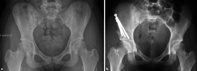 graphic file with name 64_2022_771_Fig18_HTML.jpg