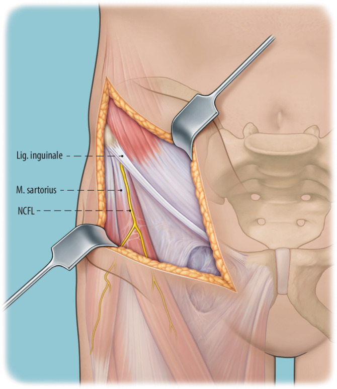 graphic file with name 64_2022_771_Fig4_HTML.jpg