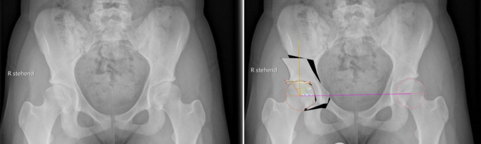 graphic file with name 64_2022_771_Fig1_HTML.jpg