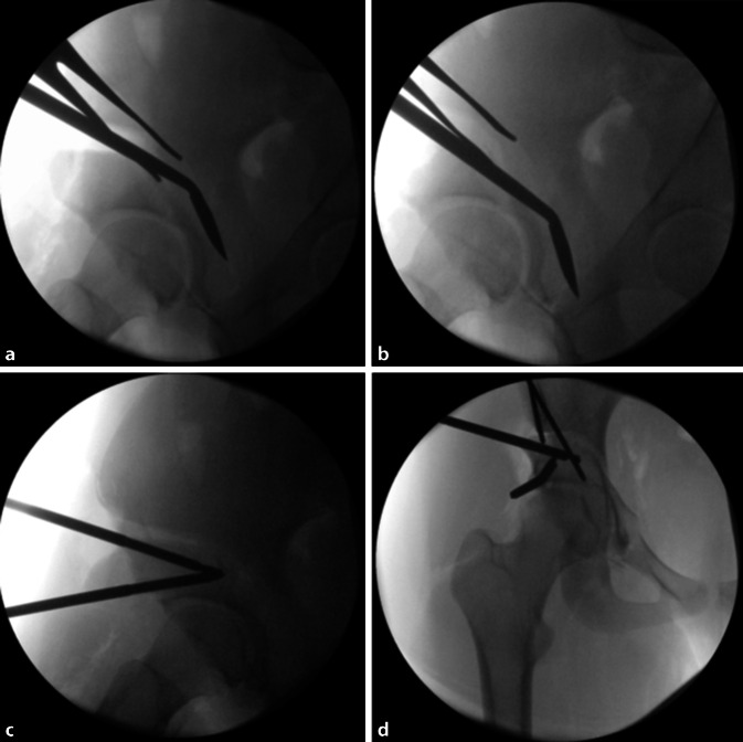 graphic file with name 64_2022_771_Fig14_HTML.jpg