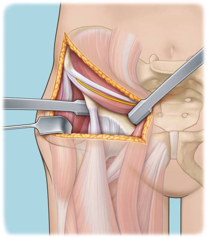 graphic file with name 64_2022_771_Fig11_HTML.jpg